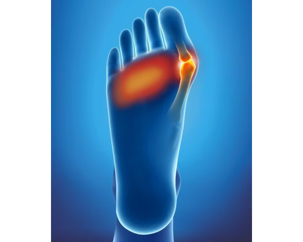 Coussinet Double Protection - Epitact