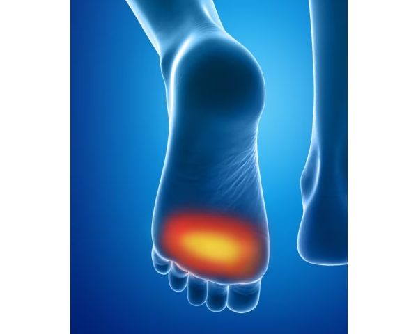 Coussinets Plantaires Epitact