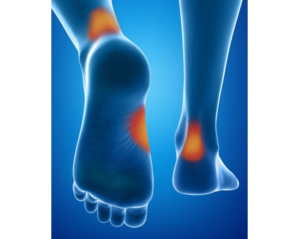 Protections anti-ampoules Epitact