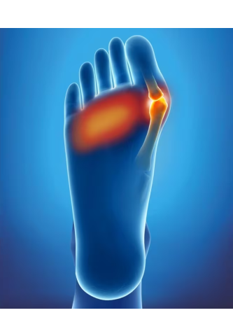 Coussinet Double Protection - Epitact