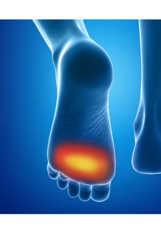 Coussinets Plantaires Epitact