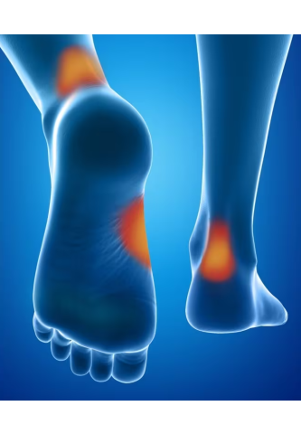 Protections anti-ampoules Epitact