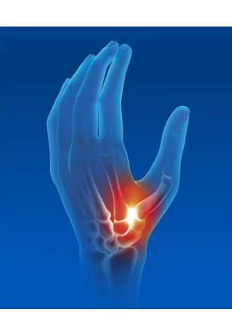 Orthèse Pouce Rigide de Repos Epitact