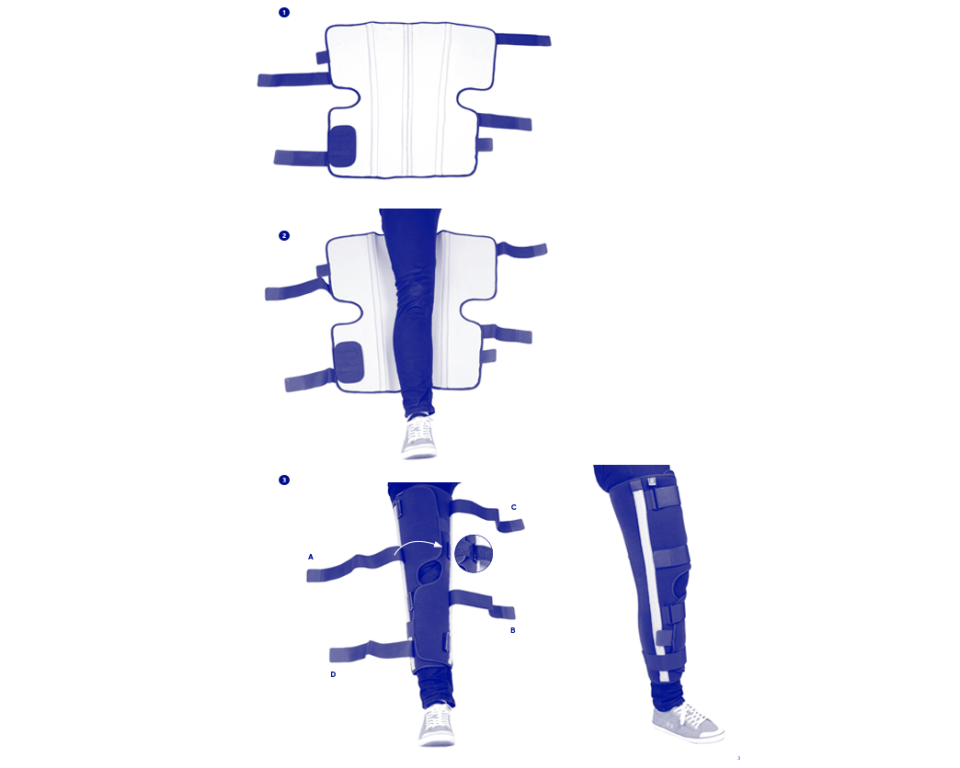 Attelle de Genou 3 Volets Immobilisation 0°