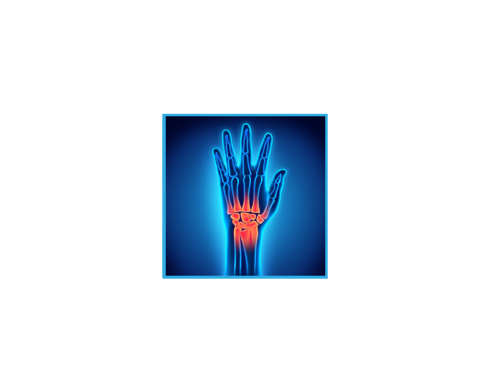 Attelle de Poignet Cryothérapie HANDFREEZ