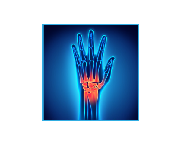 Attelle de Poignet Cryothérapie HANDFREEZ